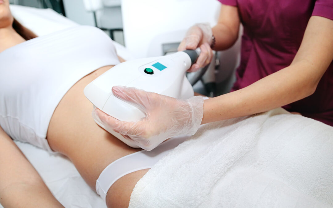 Getting Ready for Summer: The Benefits of Starting CoolSculpting Now